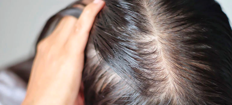 6 Myths About Laser Hair Treatment