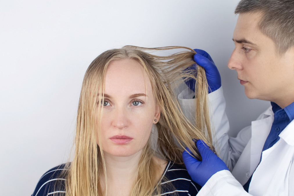 Oily Hair Treatment